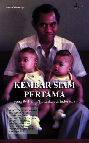 Kembar Siam Pertama yang Berhasil Dipisahkan di Indonesia