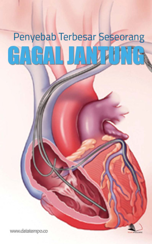 Penyebab Terbesar Seseorang Gagal Jantung