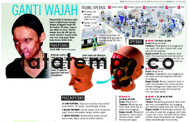 Operasi wajah Siti Nur Jazilah